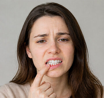 WHAT ARE MOUTH SORES, AND WHY DO THEY HAPPEN?