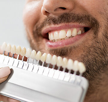 What is the Durability of Dental Veneers with Adequate Maintenance?