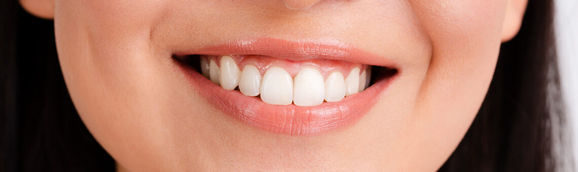 Considering a Smile Makeover? Here’s Why Veneers Are Your Best Option!