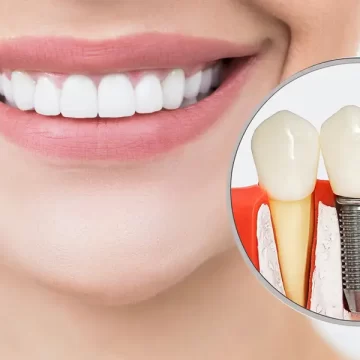 Top Reasons Dental Implants Are a Good Tooth Replacement Choice in Caro, MI