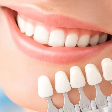 Dental Veneers in North Branch: Fix Chips, Gaps, and Stains Effectively