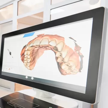 Where Can I Get a 3D Smile Preview in North Branch, MI? Meet the iTero Scanner?